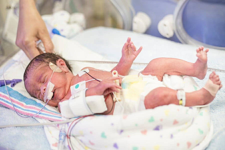 Newborn Premature Baby In The Nicu Intensive Care