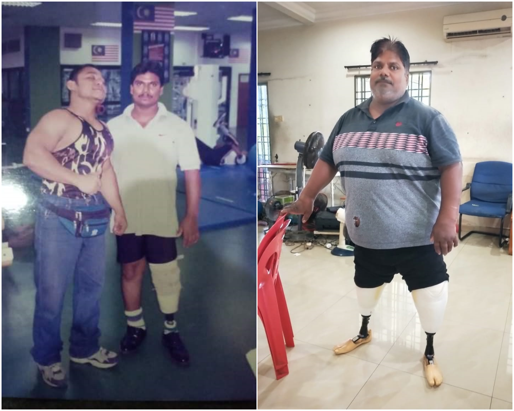 Collage Of Mogan Subramaniam. Left Is An Old Picture When He Was Younger And He Still Had His Right Leg. Right Is Recent As Both Legs Are Supported With A Prosthetic Leg.